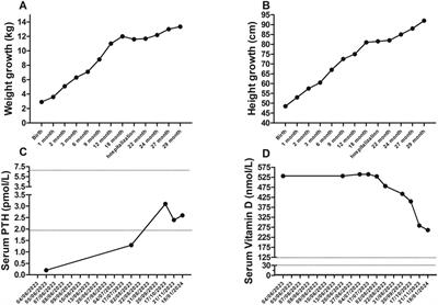 Case Report: Nephrocalcinosis in an infant due to vitamin-D food supplement overdose